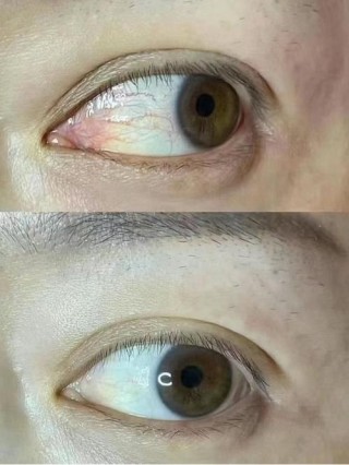 人老珠黄