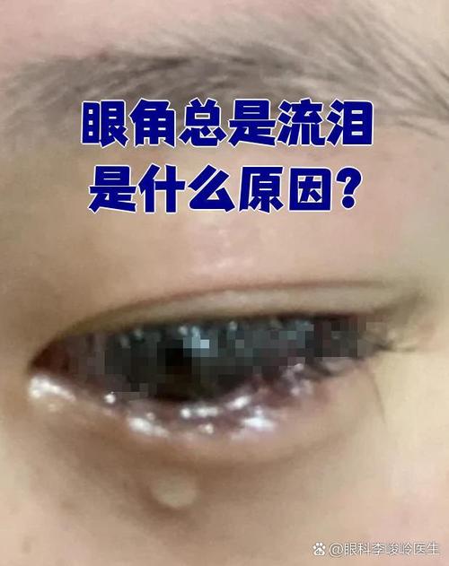 是谁让你这样的哭过  第1张
